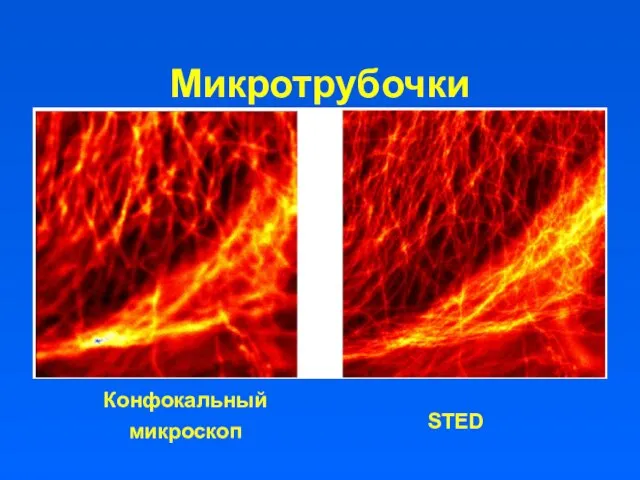 Микротрубочки Конфокальный микроскоп STED
