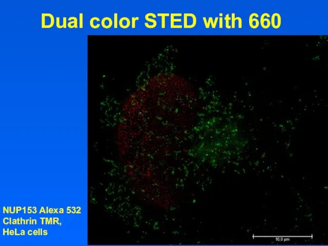 Dual color STED with 660 NUP153 Alexa 532 Clathrin TMR, HeLa cells