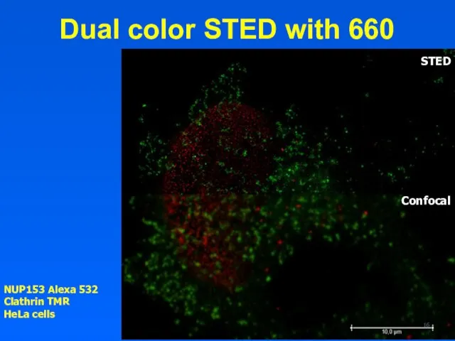 Dual color STED with 660 NUP153 Alexa 532 Clathrin TMR HeLa cells STED Confocal