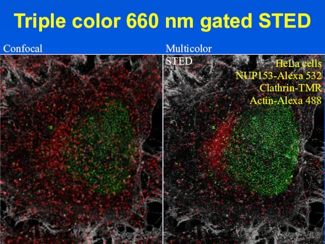 Triple color 660 nm gated STED Confocal Please enter the titel