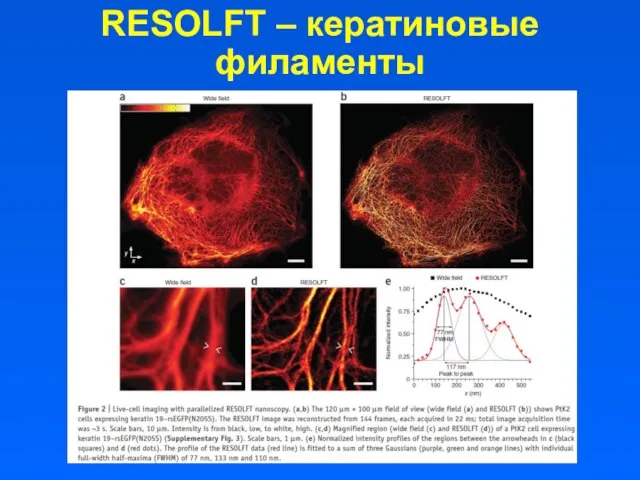 RESOLFT – кератиновые филаменты