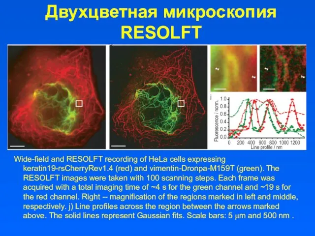 Двухцветная микроскопия RESOLFT Wide-field and RESOLFT recording of HeLa cells expressing