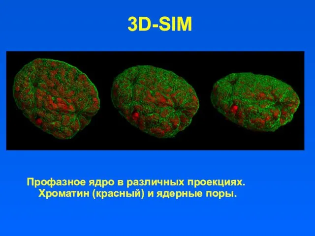 3D-SIM Профазное ядро в различных проекциях. Хроматин (красный) и ядерные поры.
