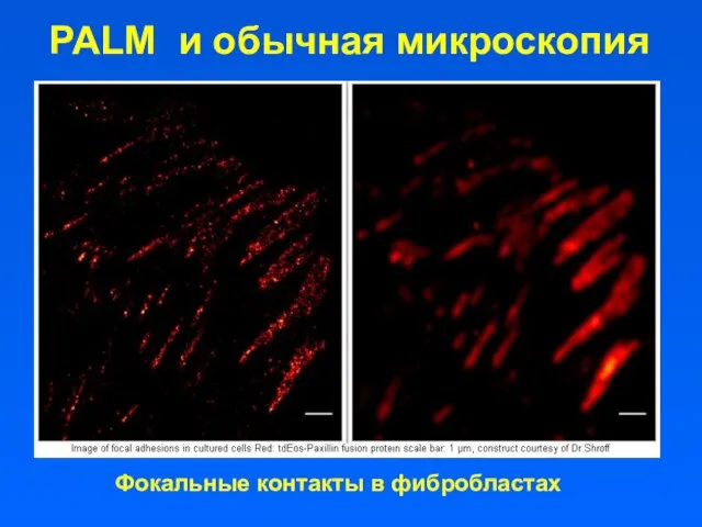PALM и обычная микроскопия Фокальные контакты в фибробластах