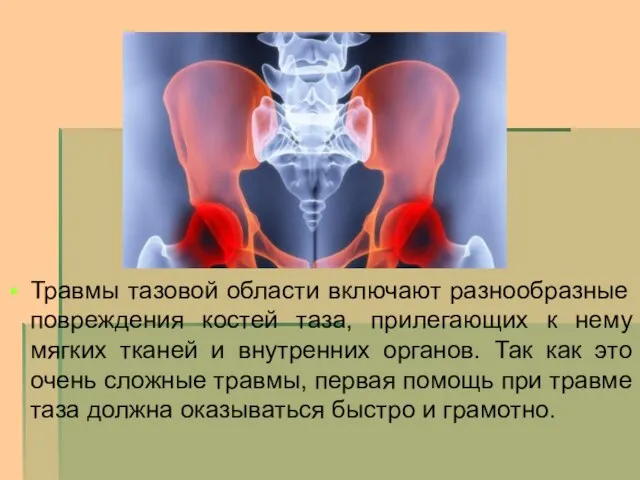 Травмы тазовой области включают разнообразные повреждения костей таза, прилегающих к нему