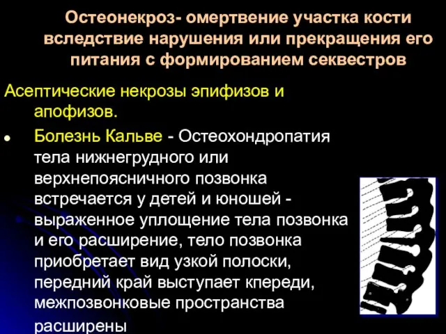 Остеонекроз- омертвение участка кости вследствие нарушения или прекращения его питания с