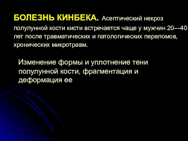 БОЛЕЗНЬ КИНБЕКА. Асептиче­ский некроз полулунной кости кисти встречается чаще у мужчин