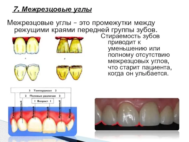 7. Межрезцовые углы Межрезцовые углы – это промежутки между режущими краями