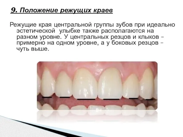 9. Положение режущих краев Режущие края центральной группы зубов при идеально