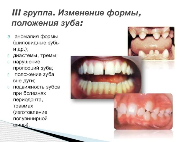 аномалия фор­мы (шиловидные зубы и др.); диастемы, тремы; нарушение пропорций зуба;