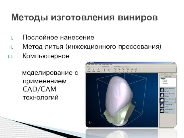 Послойное нанесение Метод литья (инжекционного прессования) Компьютерное Методы изготовления виниров моделирование с применением CAD/CAM технологий