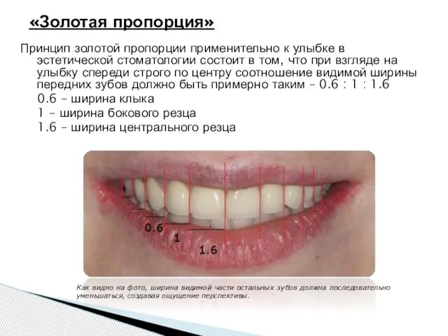 «Золотая пропорция» Как видно на фото, ширина видимой части остальных зубов