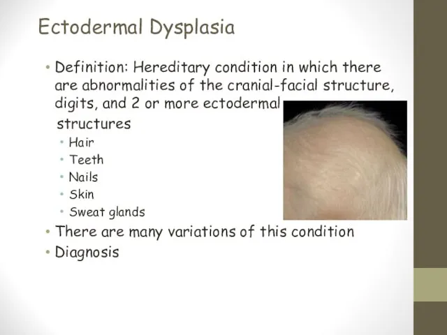 Ectodermal Dysplasia Definition: Hereditary condition in which there are abnormalities of