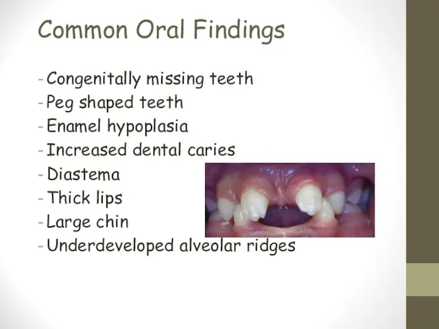 Common Oral Findings Congenitally missing teeth Peg shaped teeth Enamel hypoplasia