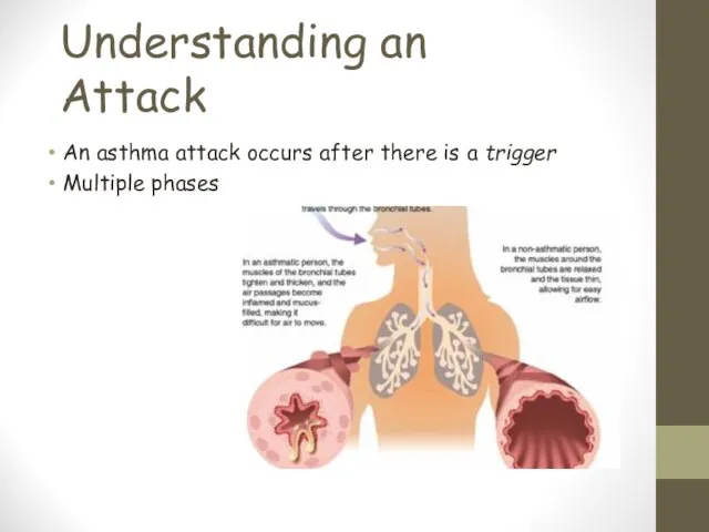 Understanding an Attack An asthma attack occurs after there is a trigger Multiple phases