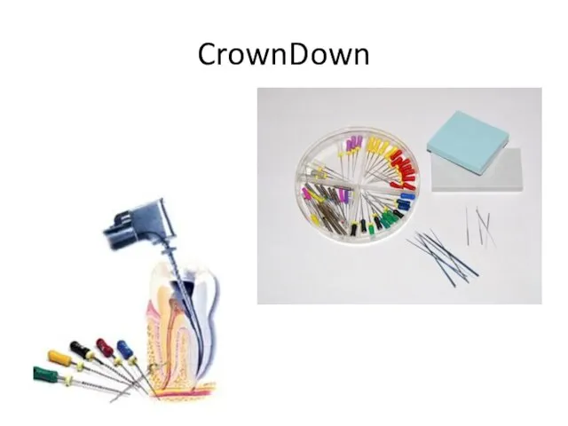 CrownDown