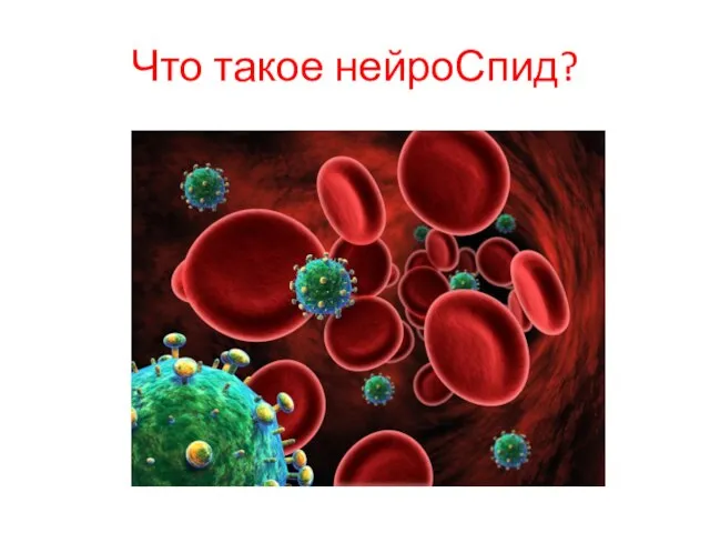 Что такое нейроСпид?