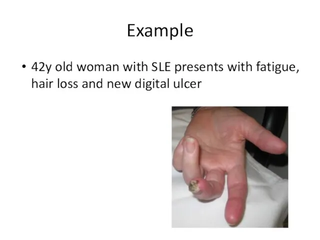 Example 42y old woman with SLE presents with fatigue, hair loss and new digital ulcer