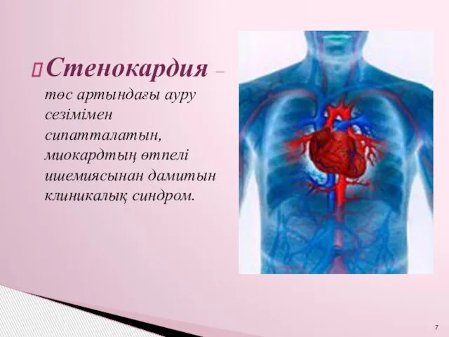 Стенокардия – төс артындағы ауру сезімімен сипатталатын, миокардтың өтпелі ишемиясынан дамитын клиникалық синдром.