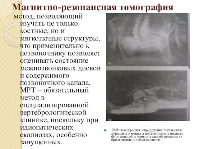 Магнитно-резонансная томография метод, позволяющий изучать не только костные, но и мягкотканые