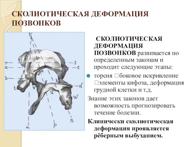 СКОЛИОТИЧЕСКАЯ ДЕФОРМАЦИЯ ПОЗВОНКОВ СКОЛИОТИЧЕСКАЯ ДЕФОРМАЦИЯ ПОЗВОНКОВ развивается по определенным законам и