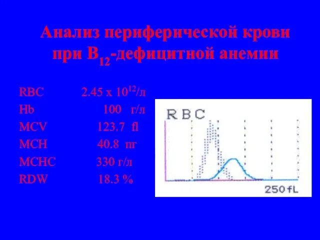 Анализ периферической крови при В12-дефицитной анемии RBC 2.45 x 1012/л Hb