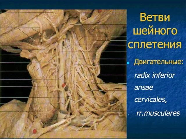 Ветви шейного сплетения Двигательные: radix inferior ansae cervicales, rr.musculares