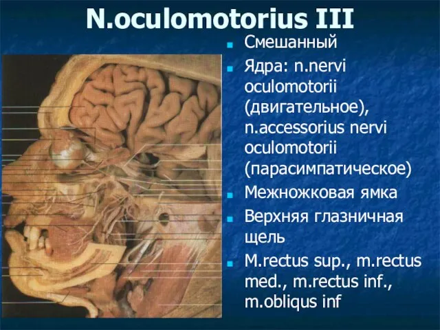 N.oculomotorius III Смешанный Ядра: n.nervi oculomotorii (двигательное), n.accessorius nervi oculomotorii (парасимпатическое)