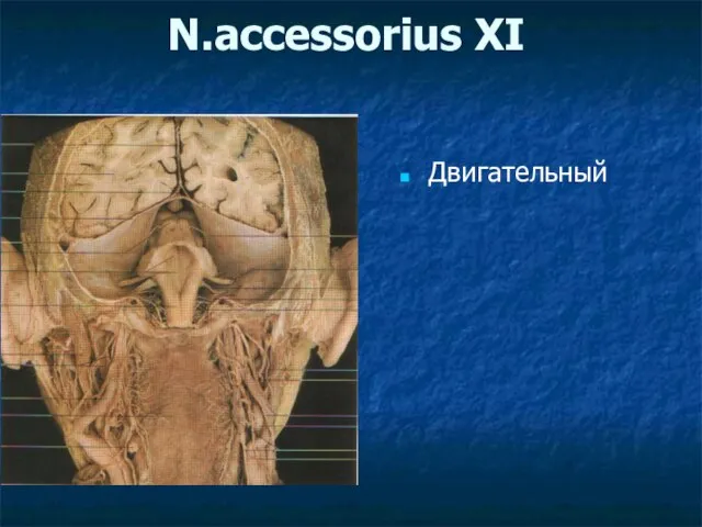 N.accessorius XI Двигательный