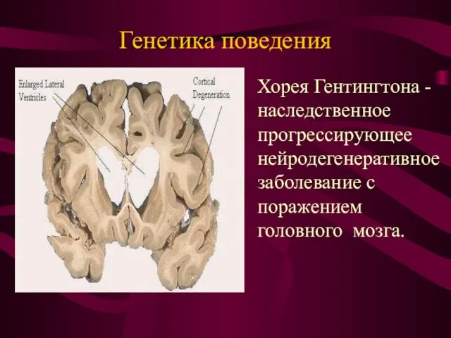 Генетика поведения Хорея Гентингтона - наследственное прогрессирующее нейродегенеративное заболевание с поражением головного мозга.