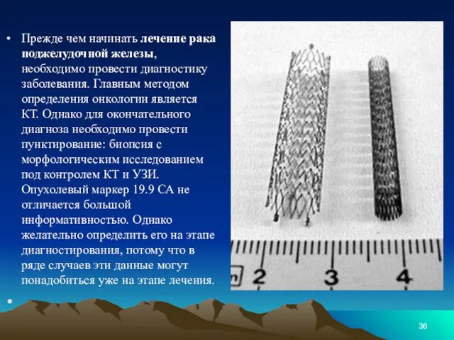 Прежде чем начинать лечение рака поджелудочной железы, необходимо провести диагностику заболевания.