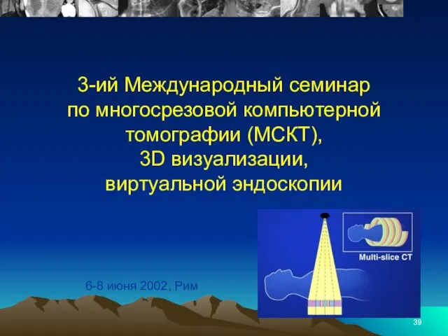 3-ий Международный семинар по многосрезовой компьютерной томографии (МСКТ), 3D визуализации, виртуальной эндоскопии 6-8 июня 2002, Рим