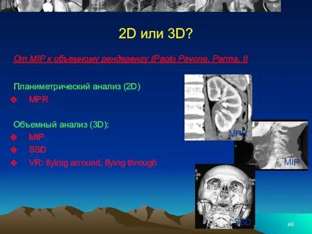 2D или 3D? От MIP к объемному рендеренгу (Paolo Pavone, Parma,