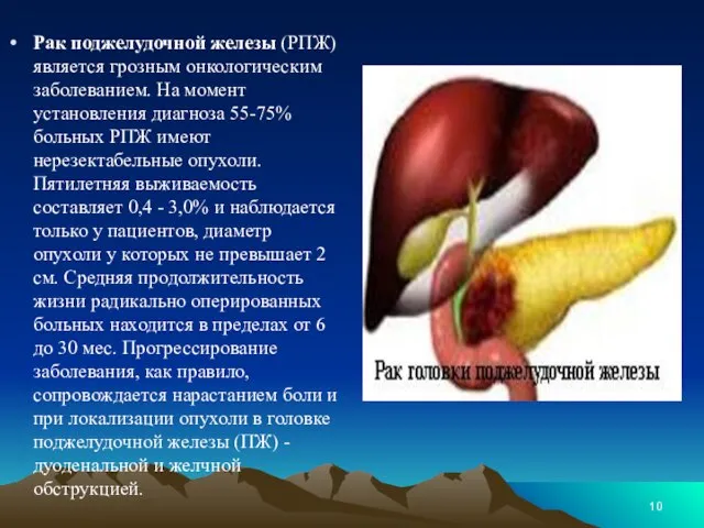 Рак поджелудочной железы (РПЖ) является грозным онкологическим заболеванием. На момент установления