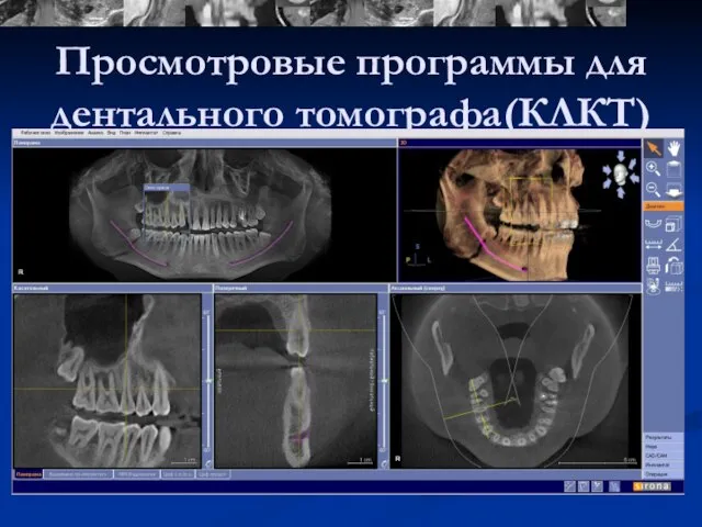 Просмотровые программы для дентального томографа(КЛКТ)