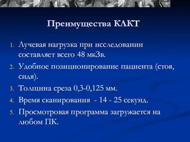 Преимущества КЛКТ Лучевая нагрузка при исследовании составляет всего 48 мкЗв. Удобное