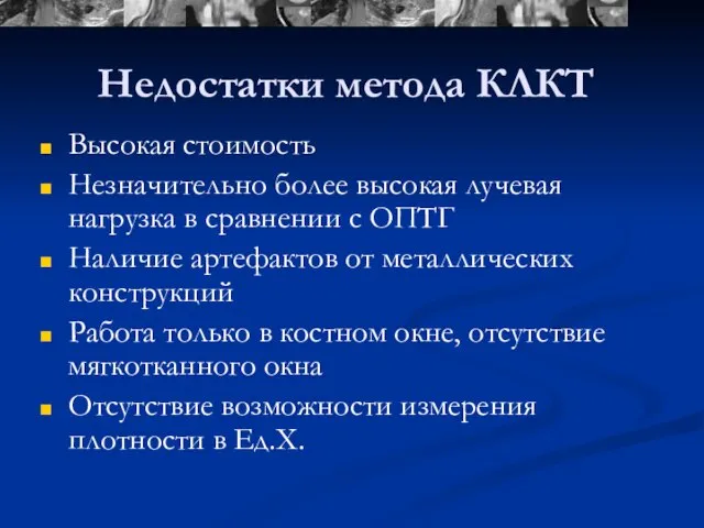 Недостатки метода КЛКТ Высокая стоимость Незначительно более высокая лучевая нагрузка в