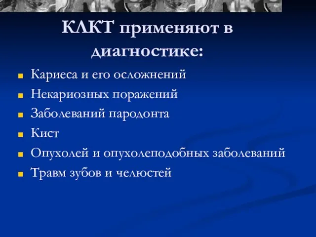 КЛКТ применяют в диагностике: Кариеса и его осложнений Некариозных поражений Заболеваний