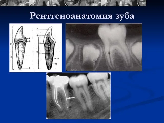 Рентгеноанатомия зуба