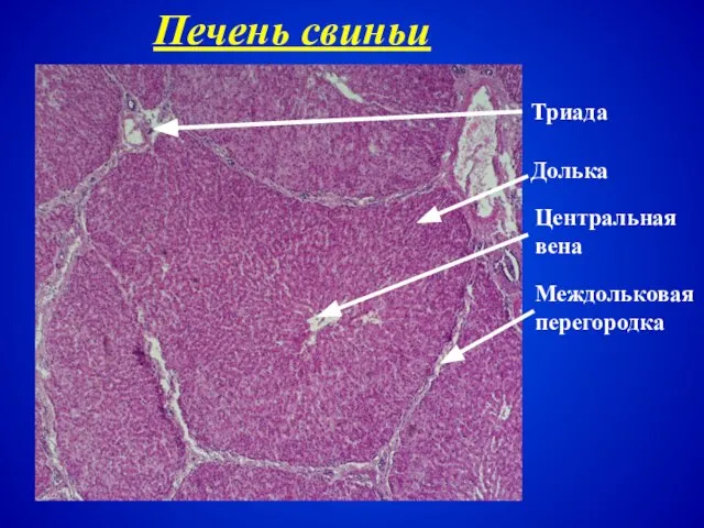 Печень свиньи Междольковая перегородка Долька Центральная вена Триада