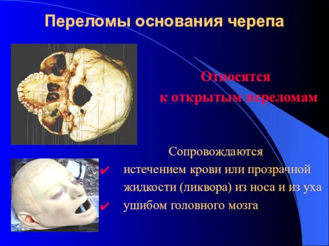 Переломы основания черепа Относятся к открытым переломам Сопровождаются истечением крови или