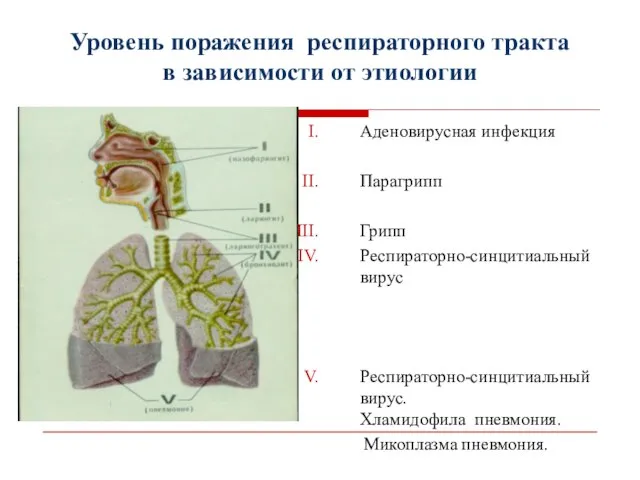 Уровень поражения респираторного тракта в зависимости от этиологии Аденовирусная инфекция Парагрипп