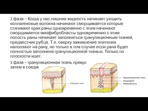 2 фаза – Когда у нас лишняя жидкость начинает уходить коллагеновые