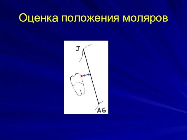 Оценка положения моляров