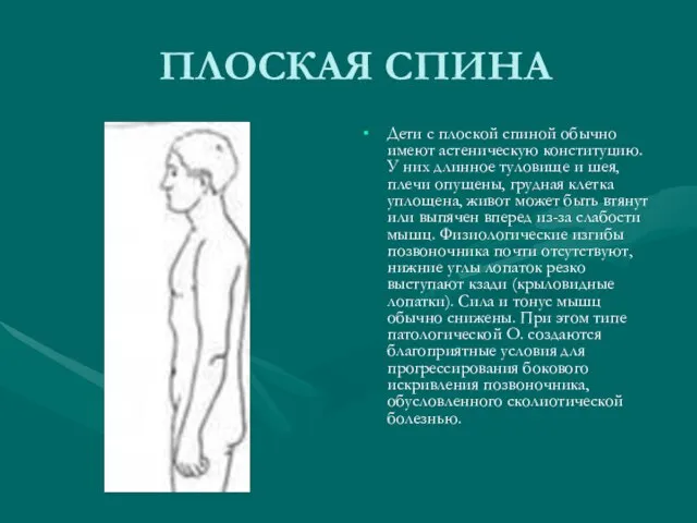 ПЛОСКАЯ СПИНА Дети с плоской спиной обычно имеют астеническую конституцию. У