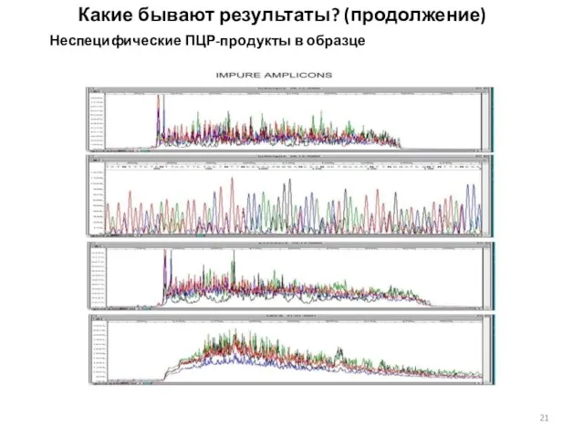 Какие бывают результаты? (продолжение) Неспецифические ПЦР-продукты в образце