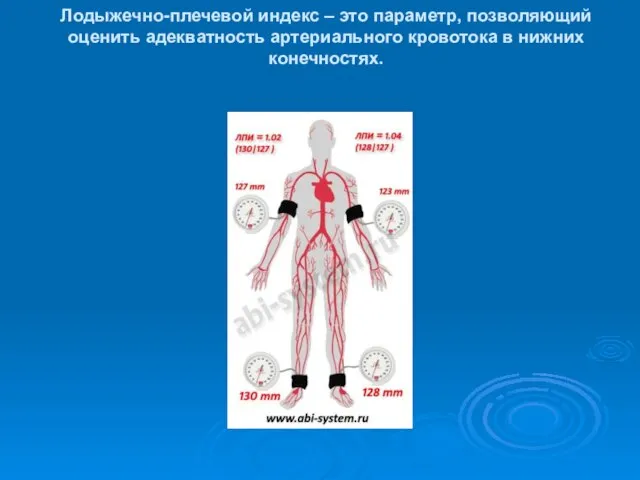 Лодыжечно-плечевой индекс – это параметр, позволяющий оценить адекватность артериального кровотока в нижних конечностях.