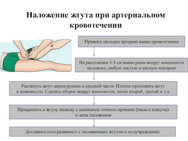 Наложение жгута при артериальном кровотечении Прижать пальцем артерию выше кровотечения На