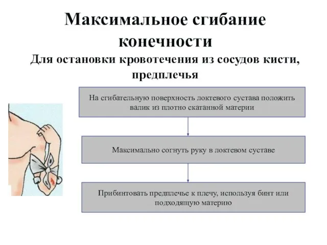 Максимальное сгибание конечности Для остановки кровотечения из сосудов кисти, предплечья На