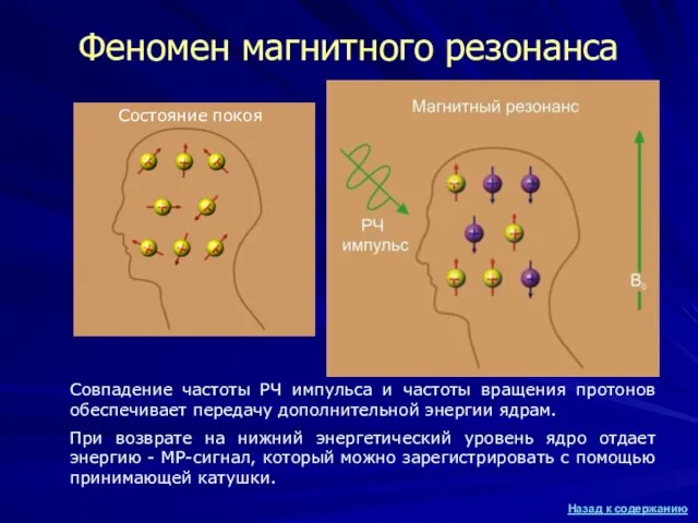 Феномен магнитного резонанса Состояние покоя Совпадение частоты РЧ импульса и частоты